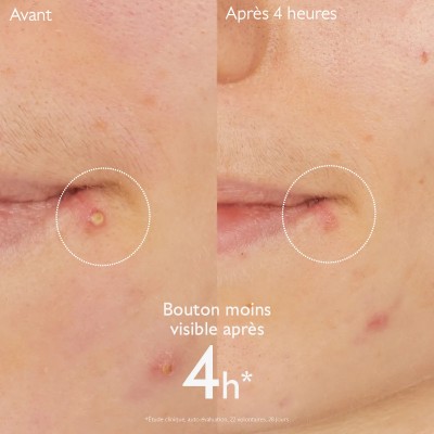 CAUDALIE VINOPURE STOP BOUTONS SALICYLIQUE 15ML