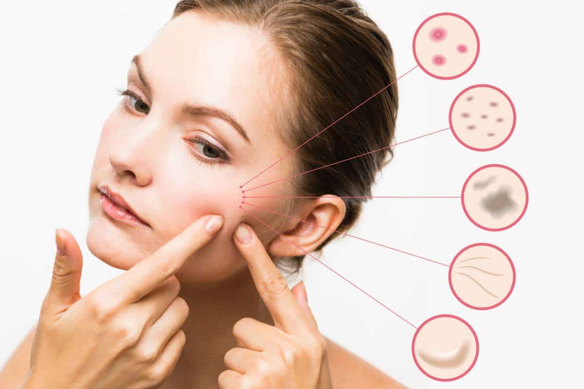 10 ASTUCES POUR TRAITER UNE PEAU GRASSE