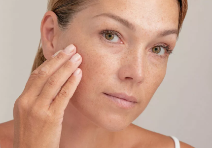 Adieu taches brunes : découvrez les secrets d’une peau éclatante et uniforme